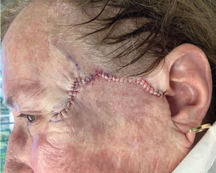 6.-Immediately-after-Dr.-G-repair
